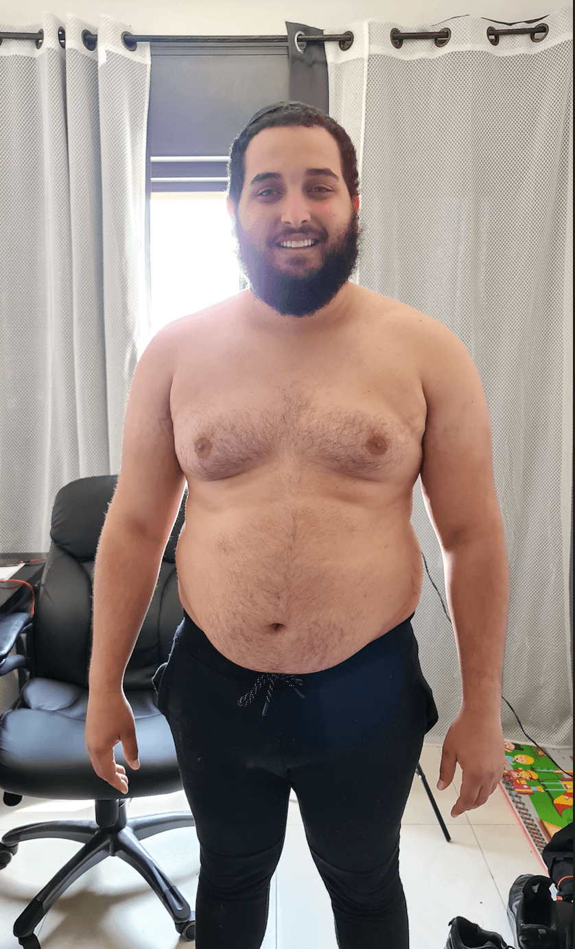 Antes — dia 1 do protocolo de jejum intermitente e dieta ancestral, 25kg de excesso de gordura inflamatória