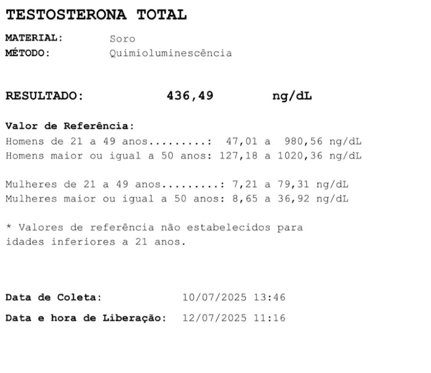 Exame de testosterona antes do protocolo, com resultado de 436 ng/dL